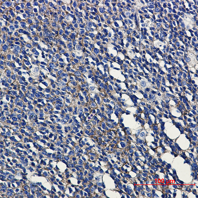 Immunohistochemical of MHC class I in Human tonsil tissue using MHC class I antibody at dilution 1:50