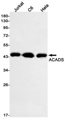 Western blot detection of ACADS in Jurkat,C6,Hela cell lysates using ACADS Rabbit mAb(1:1000 diluted).Predicted band size:44kDa.Observed band size:44kDa.