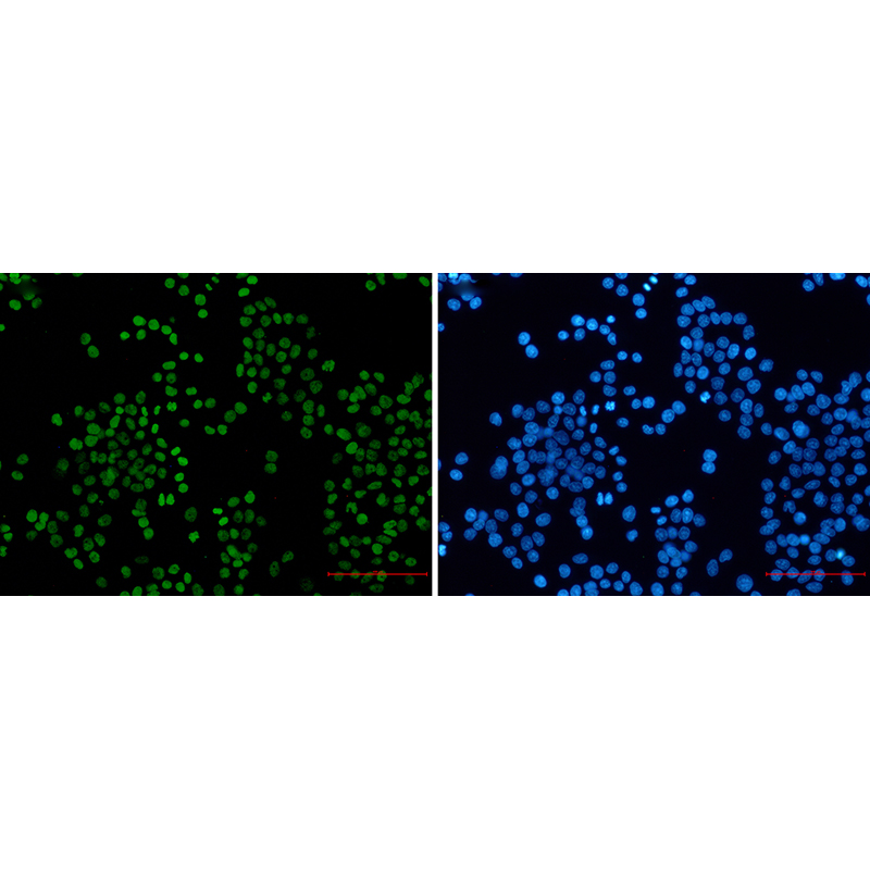 Immunofluorescence of Histone H3 (acetyl-Lys27)(green) in hela using Histone H3 (acetyl-Lys27) Rabbit mAb at dilution 1:50, and DAPI(blue)