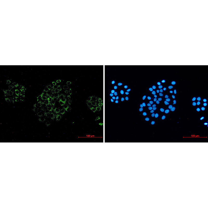 Immunofluorescence of ACOX1  (green) in hela using ACOX1 Rabbit mAb at dilution 1/50, and DAPI(blue)