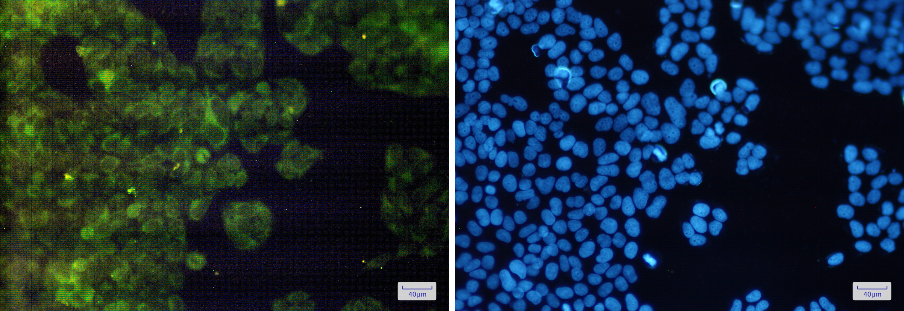 Immunofluorescence of AdSS 2(green) in Hela cells using AdSS 2 Rabbit mAb at dilution 1:200, and DAPI(blue)