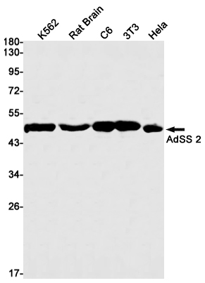 Western blot detection of AdSS 2 in K562,Rat Brain,C6,3T3,Hela cell lysates using AdSS 2 Rabbit mAb(1:1000 diluted).Predicted band size:50kDa.Observed band size:50kDa.