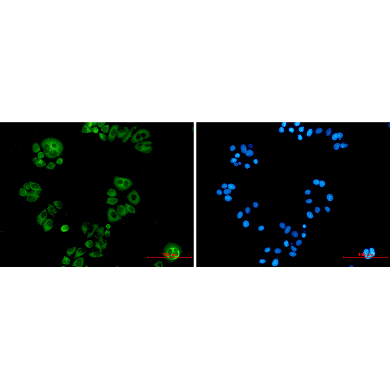 Immunofluorescence of Alkaline Phosphatase, Tissue Non-Specific(green) in hela using Alkaline Phosphatase, Tissue Non-Specific Rabbit mAb at dilution 1:50, and DAPI(blue)