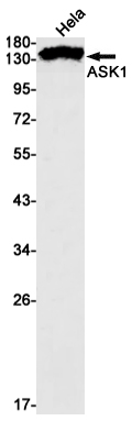 Western blot detection of ASK1 in Hela cell lysates using ASK1 Rabbit mAb(1:1000 diluted).Predicted band size:155kDa.Observed band size:155kDa.