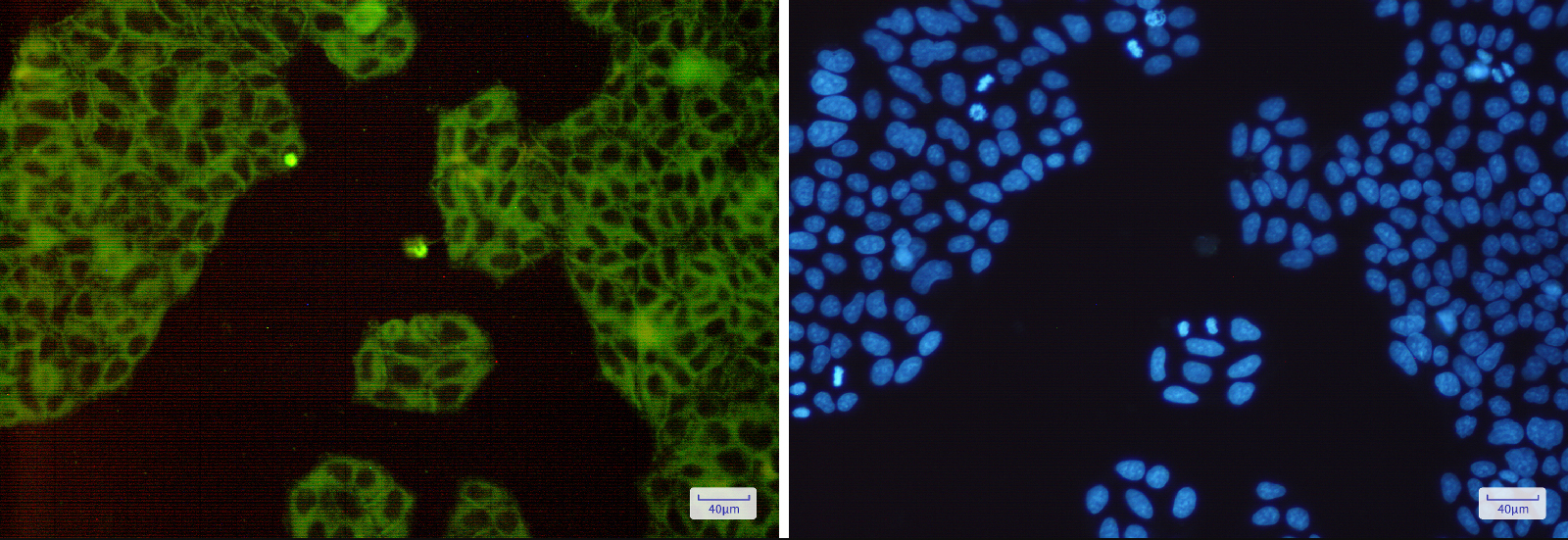 Immunofluorescence of Met (c-Met)(green) in Hela cells using Met (c-Met) Rabbit mAb at dilution 1:200, and DAPI(blue)