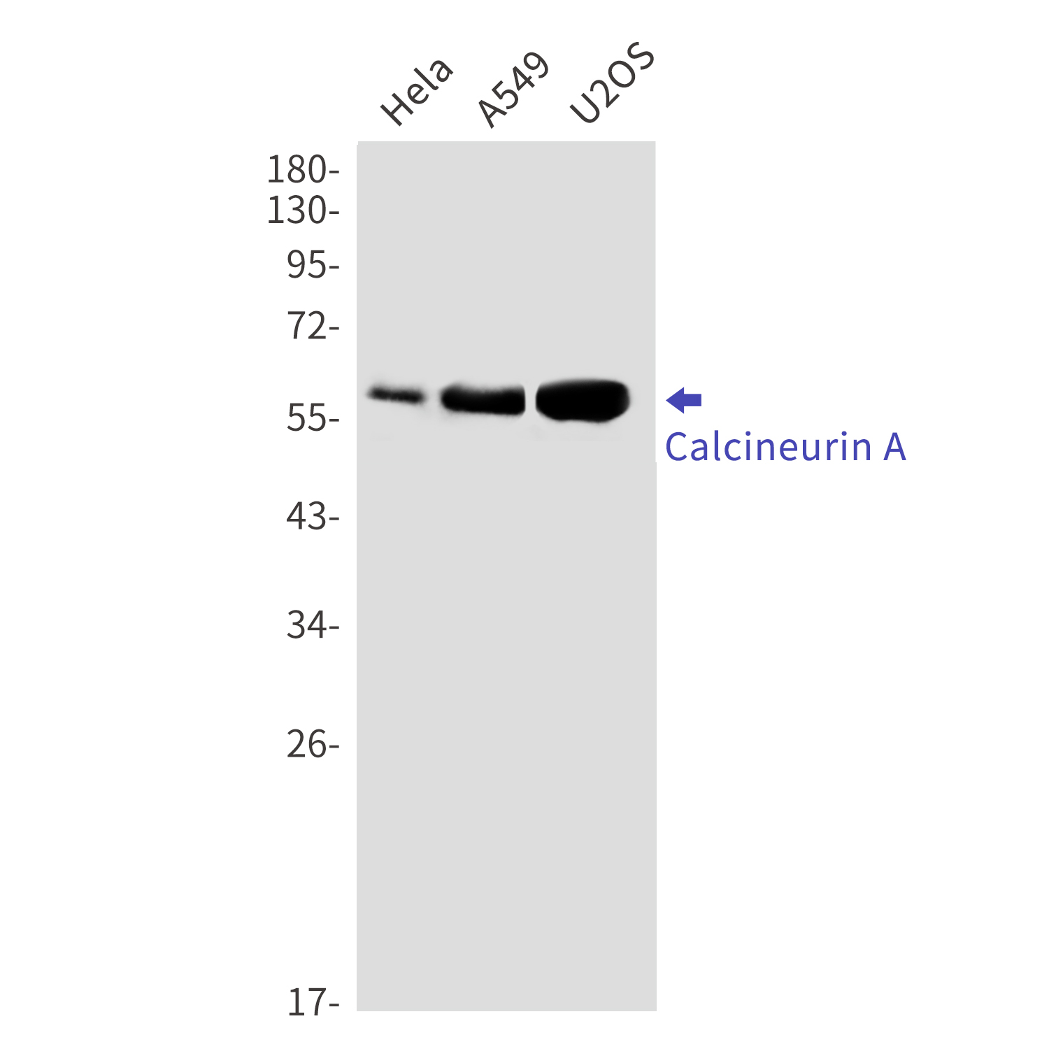 Western blot detection of Calcineurin A in Hela,A549,U2OS cell lysates using Calcineurin A Rabbit mAb(1:1000 diluted).Predicted band size:59kDa.Observed band size:59kDa.