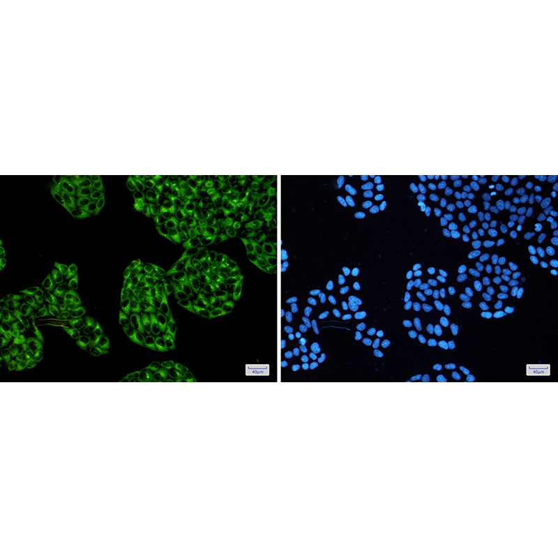 Immunofluorescence of cAMP Protein Kinase Catalytic subunit (green) in Hela cells using cAMP Protein Kinase Catalytic subunitRabbit mAb at dilution 1:50, and DAPI(blue)