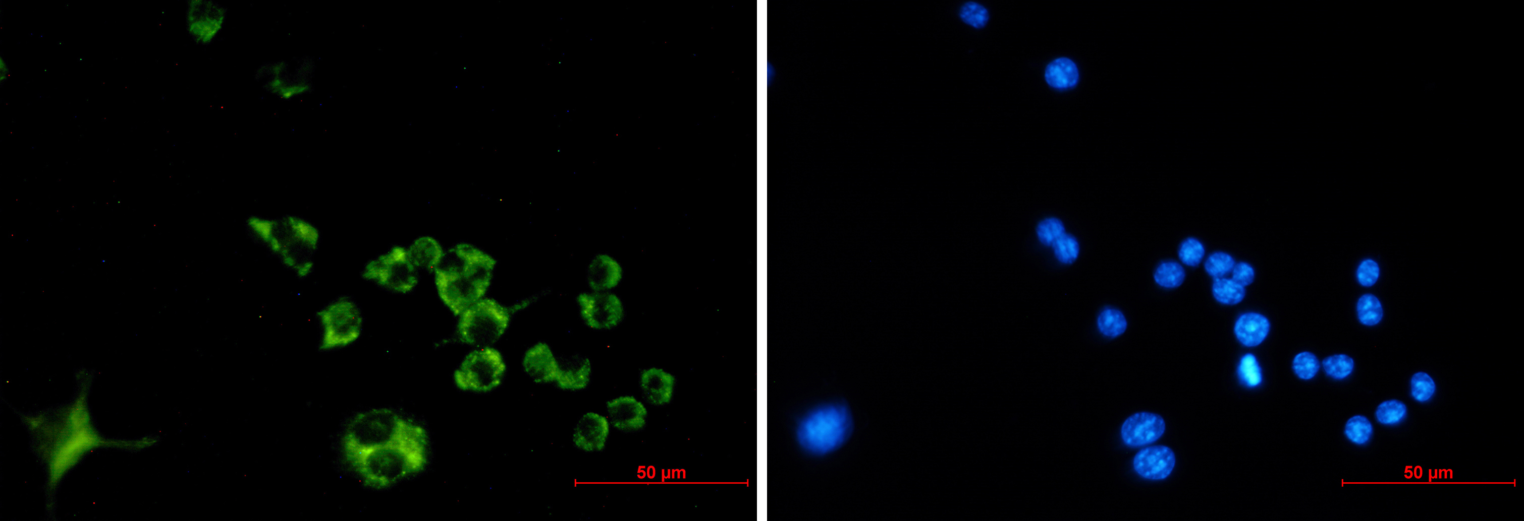 Immunofluorescence of Cathepsin B (green) in Raw264.7 using Cathepsin B antibody at dilution 1:50, and DAPI(blue)