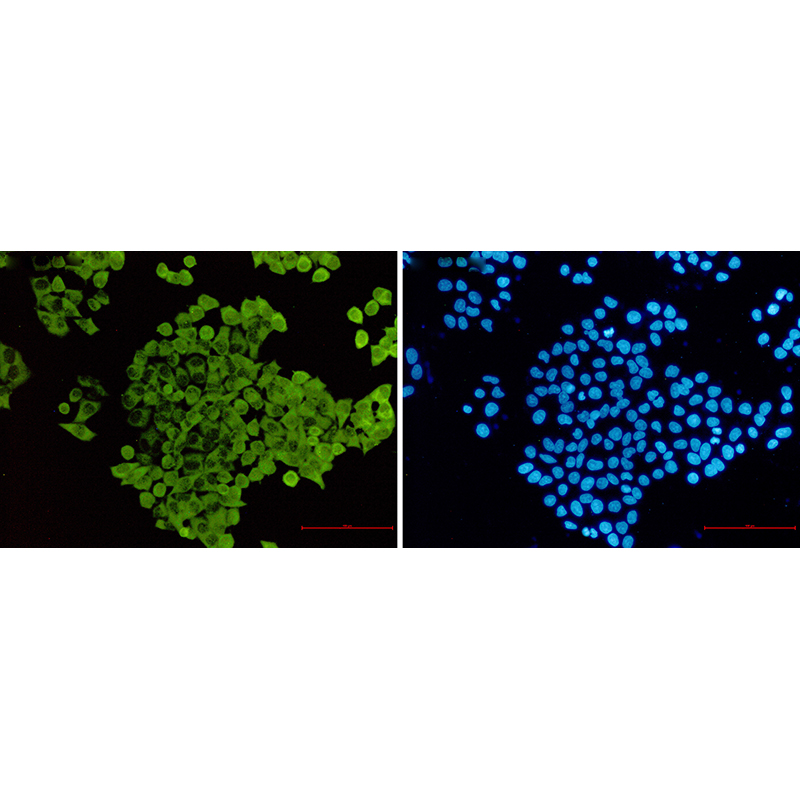 Immunofluorescence of Cofilin(green) in hela using Cofilin Rabbit mAb at dilution 1:50, and DAPI(blue)