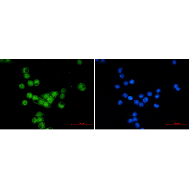 Immunofluorescence of Cyclin E2 (green) in MCF-7 using Cyclin E2 antibody at dilution 1:20, and DAPI(blue)