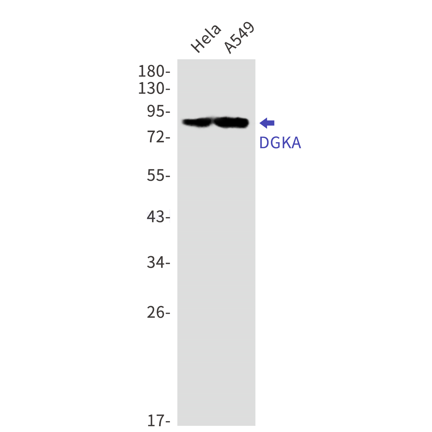 Western blot detection of DGKA in Hela,A549 cell lysates using DGKA Rabbit mAb(1:1000 diluted).Predicted band size:83kDa.Observed band size:83kDa.