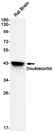Western blot detection of Doublecortin in Rat Brain cell using Doublecortin Rabbit mAb(1:1000 diluted).Predicted band size:41kDa.Observed band size:41kDa.