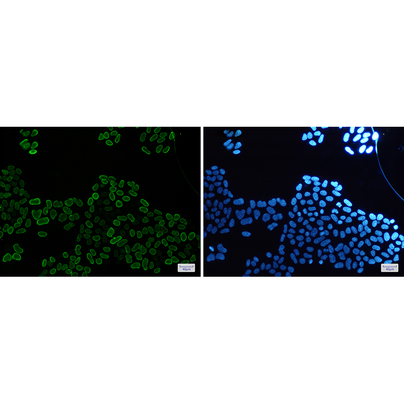 Immunofluorescence of E2F1(green) in Hela cells using E2F1 Rabbit mAb at dilution 1:50, and DAPI(blue)