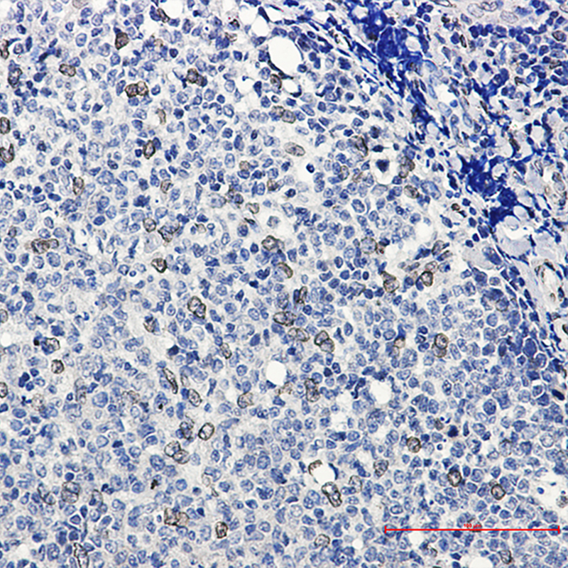 Immunohistochemistry of E2F1 in paraffin-embedded Human tonsil using E2F1 Rabbit mAb at dilution 1:20