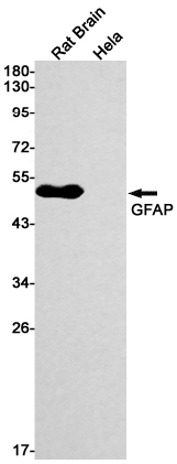 Western blot detection of GFAP in Rat Brain,Hela cell lysates using GFAP Rabbit mAb(1:1000 diluted).Predicted band size:50kDa.Observed band size:50kDa.