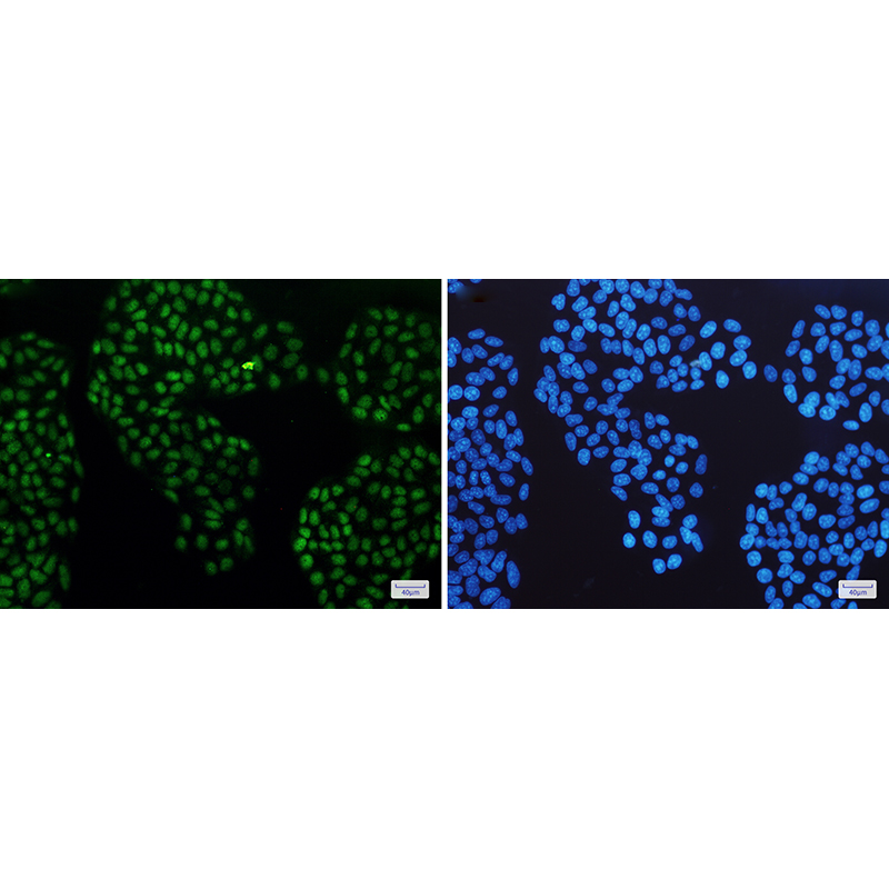 Immunofluorescence of Glucocorticoid Receptor(green) in Hela cells using Glucocorticoid Receptor Rabbit mAb at dilution 1:50, and DAPI(blue)