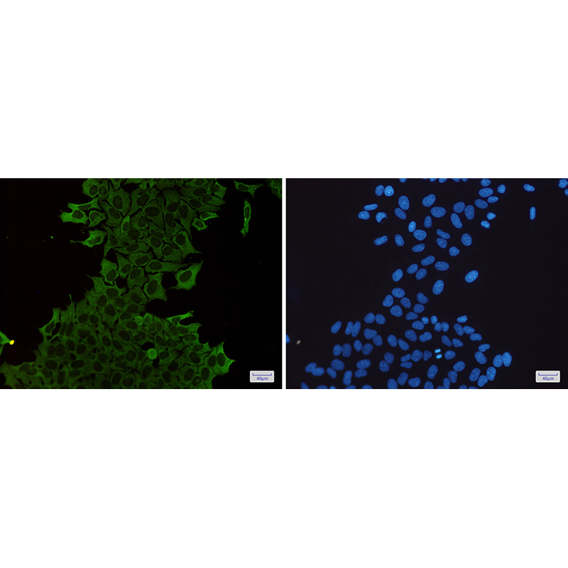 Immunofluorescence of Hsp70(green) in Hela cells using Hsp70 Rabbit mAb at dilution 1:200, and DAPI(blue)