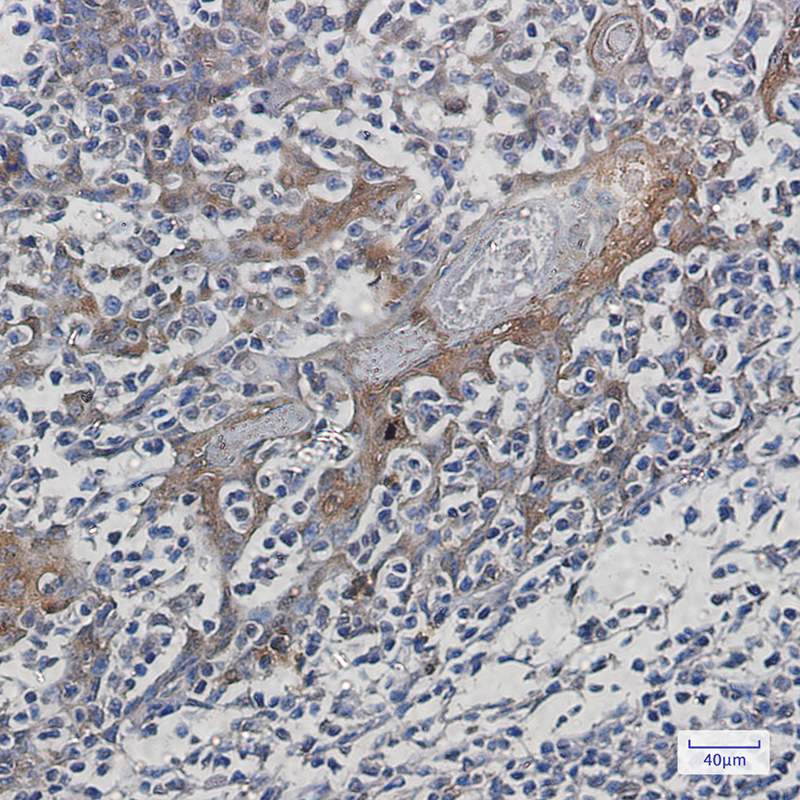 Immunohistochemistry of Hsp7 in paraffin-embedded Human tonsil using Hsp7 Rabbit mAb at dilution 1:50