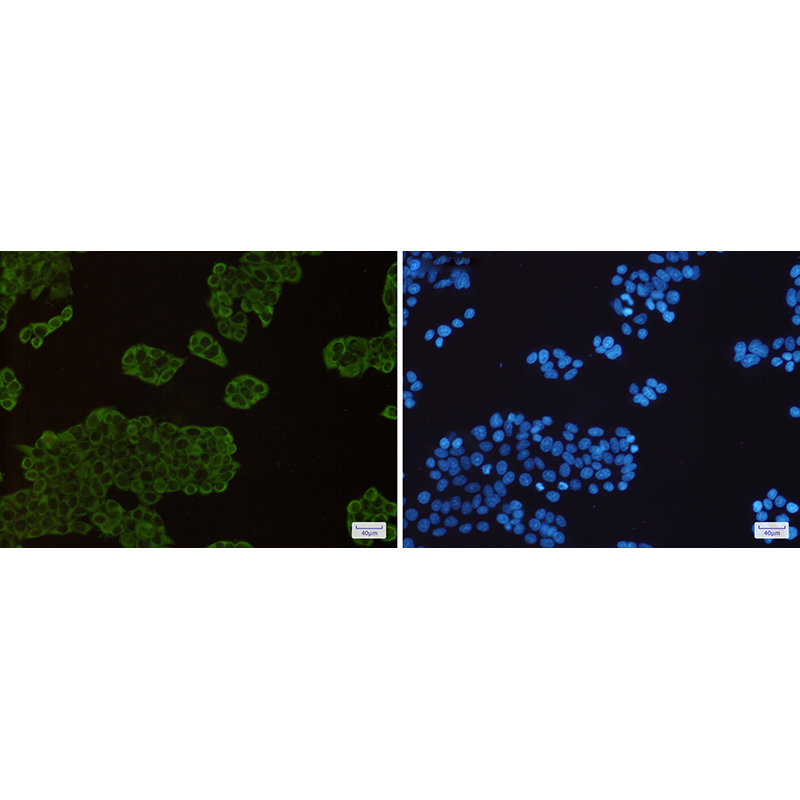 Immunofluorescence of Hsp90 alpha/beta(green) in Hela cells using Hsp90 alpha/beta Rabbit mAb at dilution 1:200, and DAPI(blue)