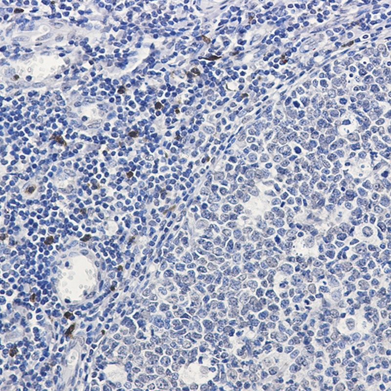 Immunohistochemistry of IL-26 in paraffin-embedded Human tonsil using IL-26 Rabbit mAb at dilution 1:50