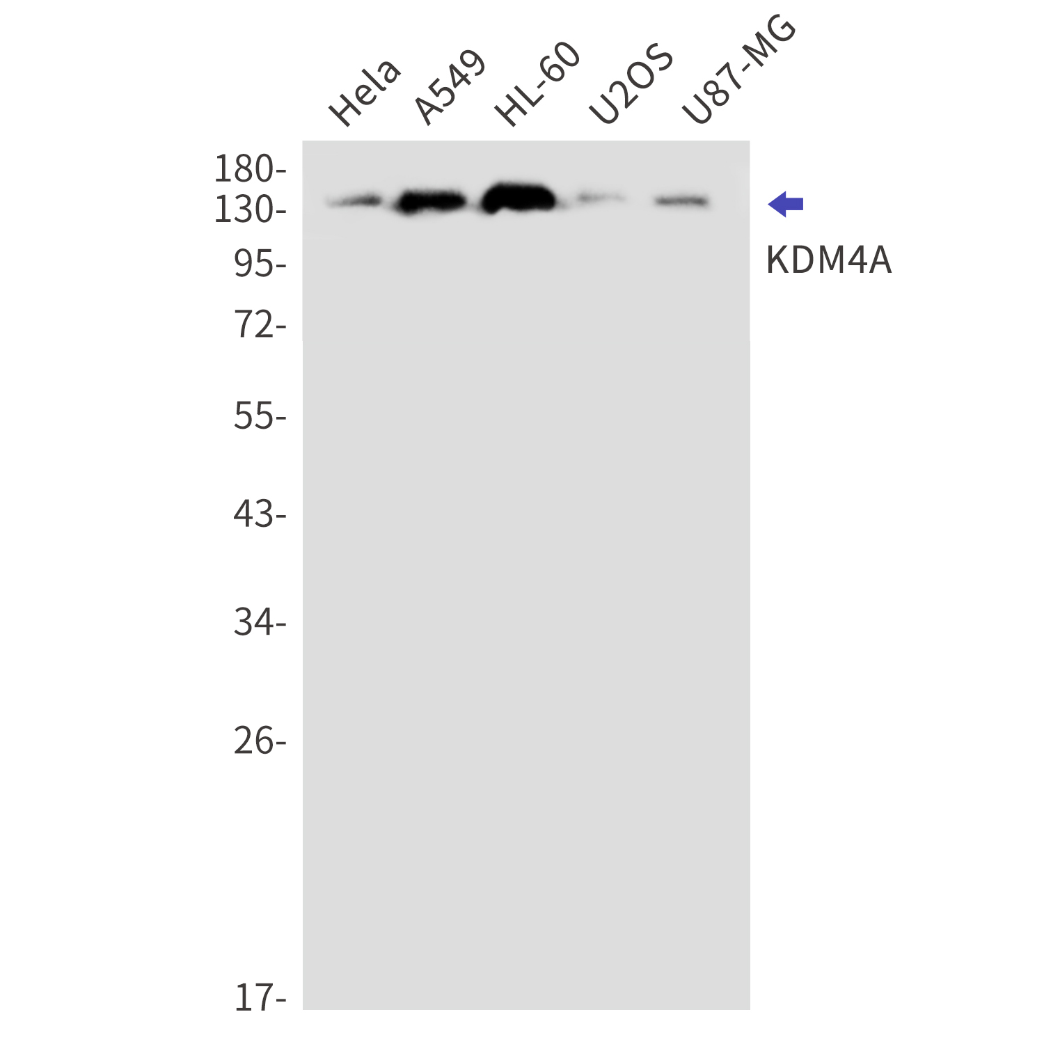 Western blot detection of KDM4A in Hela,A549,HL-60,U2OS,U87-MG cell lysates using KDM4A Rabbit mAb(1:1000 diluted).Observed band size:150kDa.