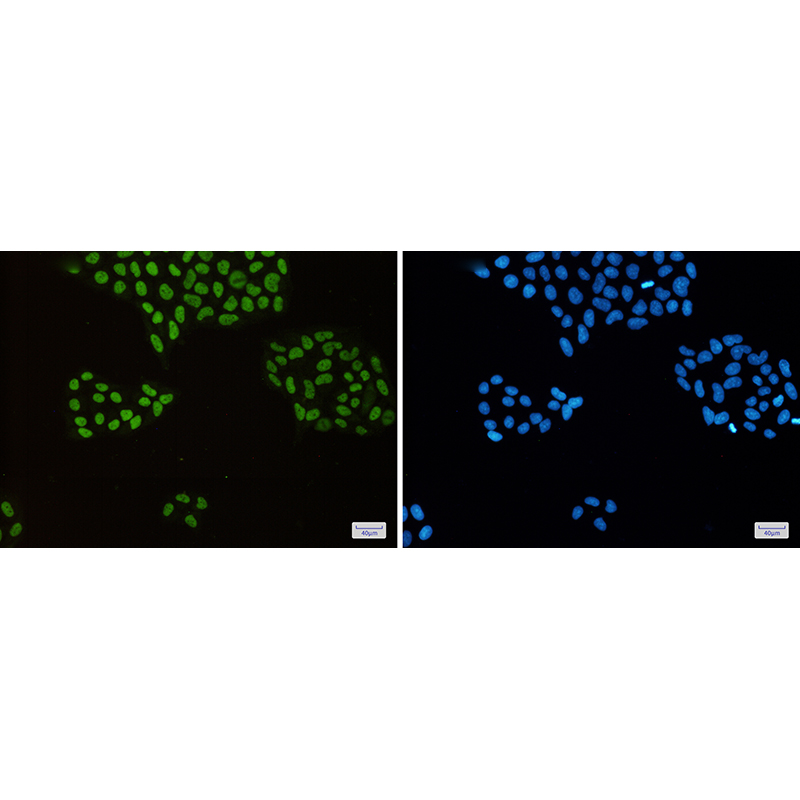 Immunofluorescence of MCM2(green) in Hela cells using MCM2 Rabbit mAb at dilution 1:50, and DAPI(blue)