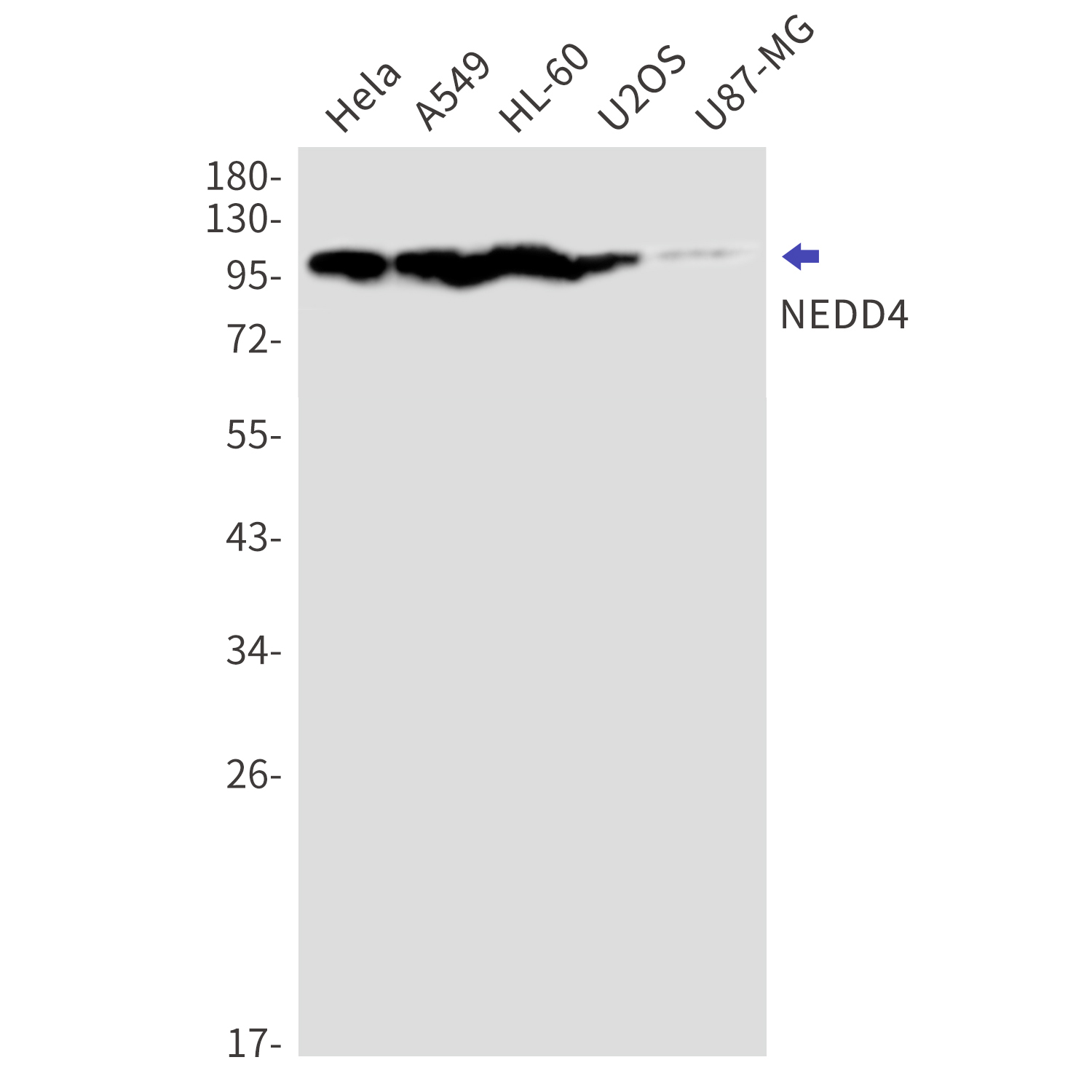 Western blot detection of NEDD4 in Hela,A549,HL-60,U2OS,U87-MG cell lysates using NEDD4 Rabbit mAb(1:1000 diluted).Predicted band size:149kDa.Observed band size:115kDa.