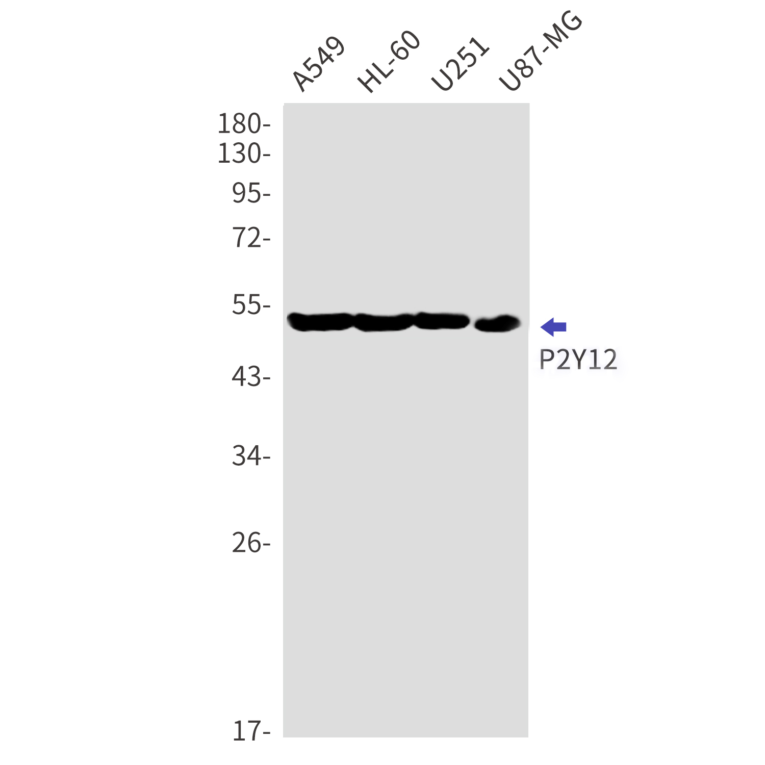 Western blot detection of P2Y12 in A549,HL-60,U251,U87-MG cell lysates using P2Y12 Rabbit mAb(1:1000 diluted).Predicted band size:40kDa.Observed band size:52kDa.