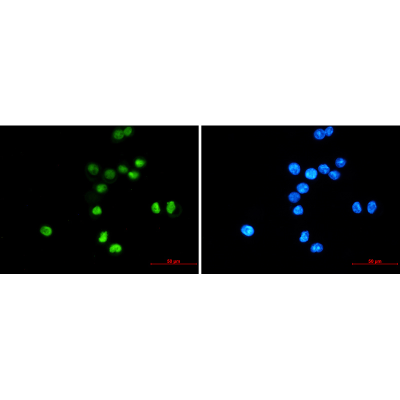 Immunofluorescence of p53 (green) in MCF-7 using p53 antibody at dilution 1:20, and DAPI(blue)