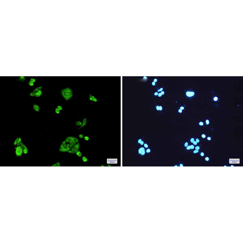 Immunofluorescence of PGD(green) in Hela cells using PGD Rabbit mAb at dilution 1:200, and DAPI(blue)