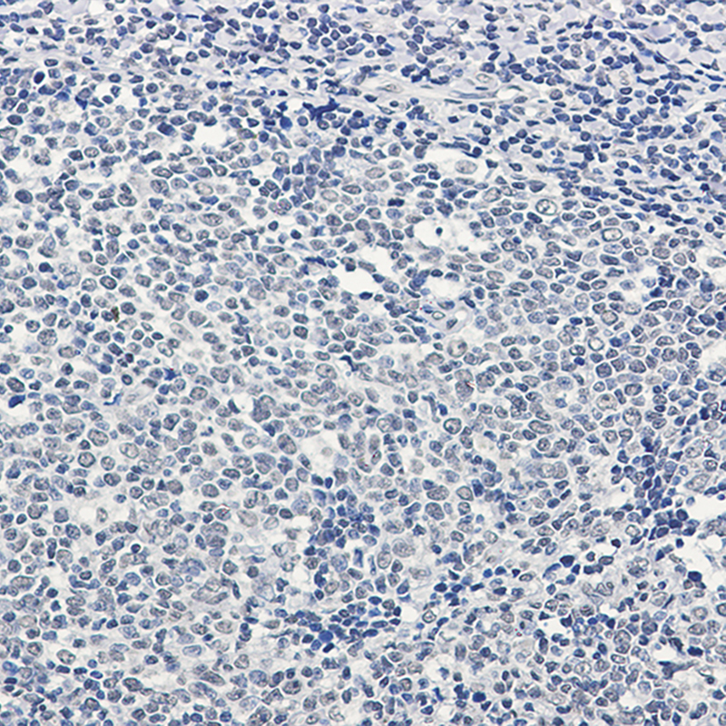 Immunohistochemistry of PTBP1 in paraffin-embedded Human tonsil using PTBP1 Rabbit mAb at dilution 1:50