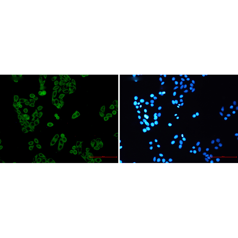 Immunofluorescence of RENT1(green) in Hela using RENT1 Rabbit mAb at dilution 1:50, and DAPI(blue)