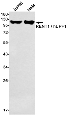 Western blot detection of RENT1 / hUPF1 in Jurkat,Hela cell lysates using RENT1 / hUPF1 Rabbit mAb(1:1000 diluted).Predicted band size:124kDa.Observed band size:124kDa.