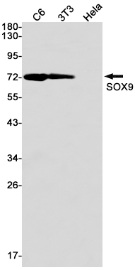 Western blot detection of SOX9 in C6,3T3,Hela cell lysates using SOX9 Rabbit mAb(1:1000 diluted).Predicted band size:56kDa.Observed band size:70kDa.