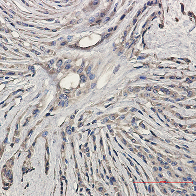 Immunohistochemistry of Synaptophysin in paraffin-embedded Human Brain using Synaptophysin Rabbit mAb at dilution 1:20