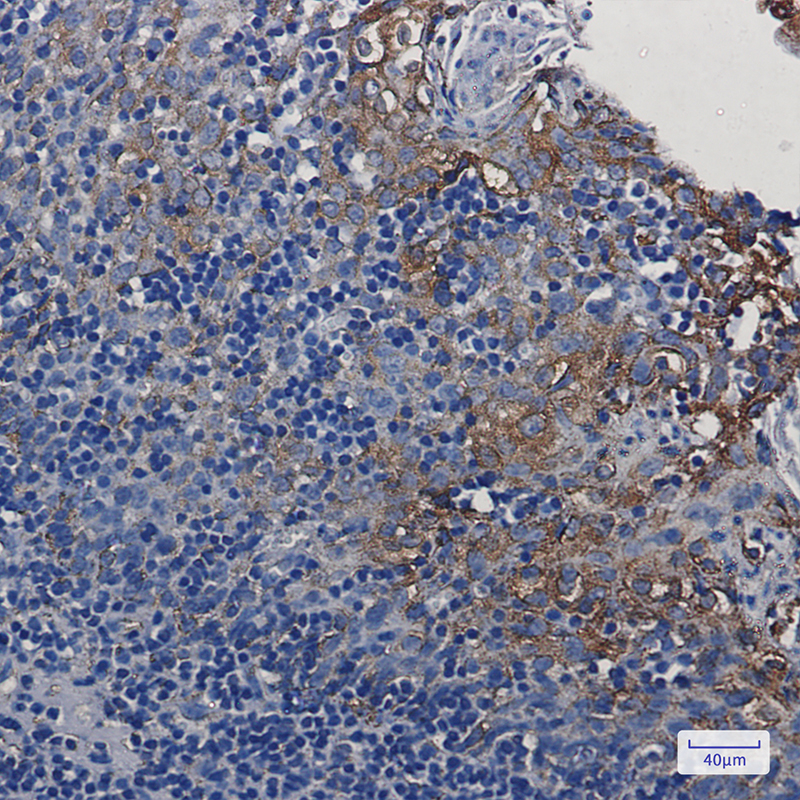 Immunohistochemistry of TMEM173 in paraffin-embedded Human tonsil using TMEM173 Rabbit mAb at dilution 1:50