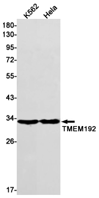 Western blot detection of TMEM192 in K562,Hela cell lysates using TMEM192 Rabbit mAb(1:1000 diluted).Predicted band size:31kDa.Observed band size:31kDa.