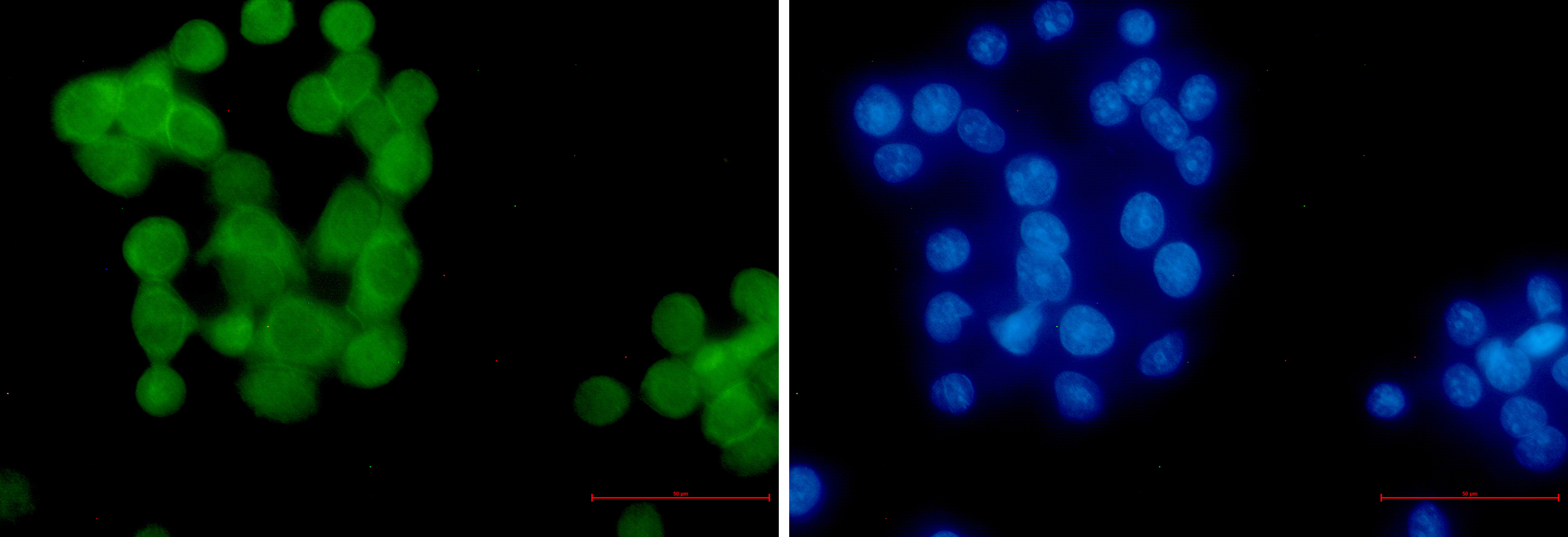 Immunofluorescence of Ubiquitin (linkage-specific K63)(green) in hela using Ubiquitin (linkage-specific K63) Rabbit mAb at dilution 1:50, and DAPI(blue)