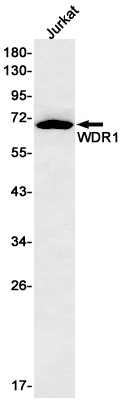 Western blot detection of WDR1 in Jurkat cell lysates using WDR1 Rabbit mAb(1:500 diluted).Predicted band size:66kDa.Observed band size:66kDa.