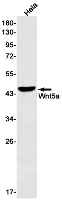 Western blot detection of Wnt5a in Hela cell lysates using Wnt5a Rabbit mAb(1:500 diluted).Predicted band size:42kDa.Observed band size:45kDa.