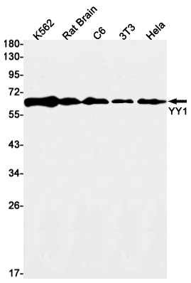 Western blot detection of YY1 in K562,Rat Brain,C6,3T3,Hela cell lysates using YY1 Rabbit mAb(1:1000 diluted).Predicted band size:45kDa.Observed band size:65kDa.