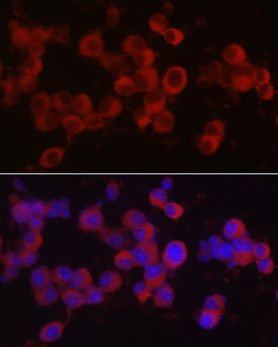 Immunofluorescence analysis of Neuro-2a cells using Ret Polyclonal Antibody at dilution of 1:50 (40x lens). Blue: DAPI for nuclear staining.