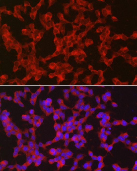 Immunofluorescence analysis of SH-SY5Y cells using Ret Polyclonal Antibody at dilution of 1:50 (40x lens). Blue: DAPI for nuclear staining.