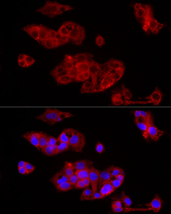 Immunofluorescence analysis of HepG2 cells using FGF1 Polyclonal Antibody at dilution of 1:100 (40x lens). Blue: DAPI for nuclear staining.