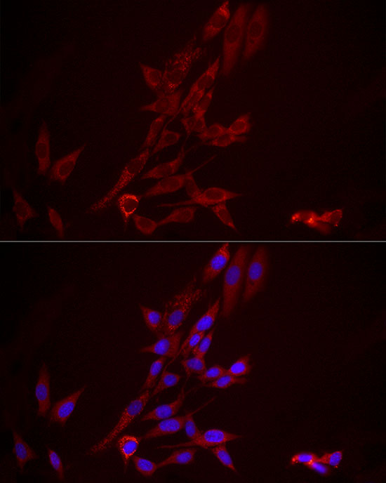 Immunofluorescence analysis of NIH/3T3 cells using FGF1 Polyclonal Antibody at dilution of 1:100 (40x lens). Blue: DAPI for nuclear staining.