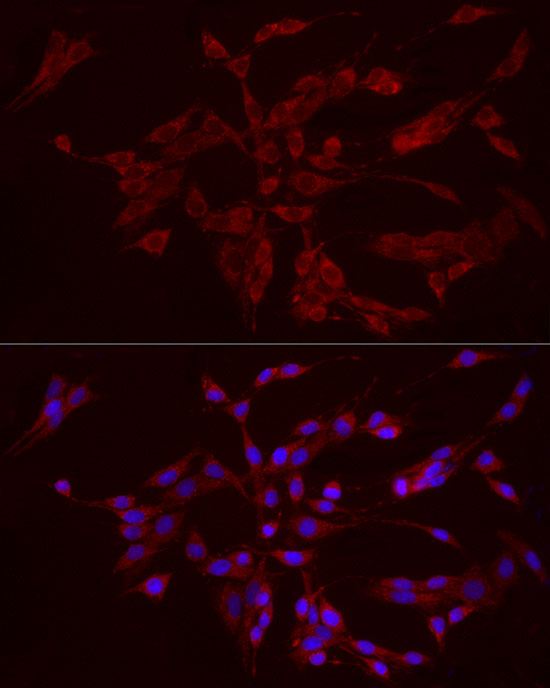 Immunofluorescence analysis of PC-12 cells using FGF1 Polyclonal Antibody at dilution of 1:100 (40x lens). Blue: DAPI for nuclear staining.