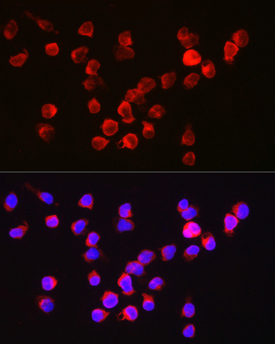 Immunofluorescence analysis of Jurkat cells using BCL2A1 Polyclonal Antibody at dilution of 1:250 (40x lens). Blue: DAPI for nuclear staining.