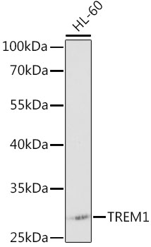 Western blot analysis of extracts of HL-60 cells using TREM1 Polyclonal Antibody at 1:1000 dilution.