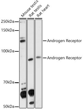 Western blot analysis of extracts of various cell lines using Androgen Receptor Polyclonal Antibody at 1:1000 dilution.