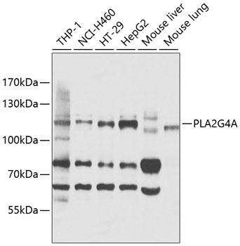 Western blot analysis of extracts of various cell lines using PLA2G4A Polyclonal Antibody at 1:1000 dilution.